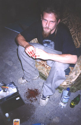 Todd's big accident, from clipping ganja.  Lille, France. 1997
